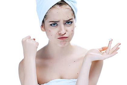 10 things to try when acne won’t clear